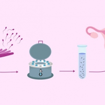 Donar Sperm
